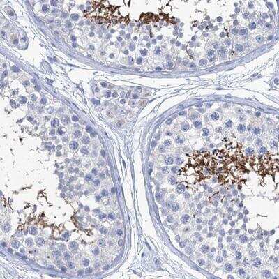 <b>Orthogonal Strategies Validation. </b>Immunohistochemistry-Paraffin: CABYR Antibody [NBP2-14429] - Staining of human testis shows strong cytoplasmic positivity in Spermatids.