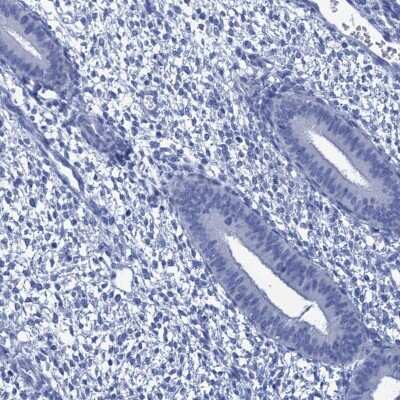 Immunohistochemistry-Paraffin: CABYR Antibody [NBP2-14429] - Staining of human endometrium shows low expression as expected.