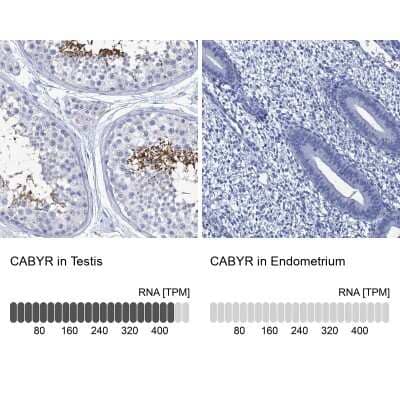 Immunohistochemistry-Paraffin: CABYR Antibody [NBP2-14429] - Staining in human testis and endometrium tissues using anti-CABYR antibody. Corresponding CABYR RNA-seq data are presented for the same tissues.