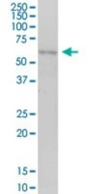 Western Blot: CABYR Antibody [H00026256-B01P] - Analysis of CABYR expression in human liver.