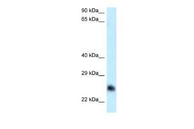 Western Blot: CABYR Antibody [NBP2-87108] - WB Suggested Anti-CABYR Antibody. Titration: 1.0 ug/ml. Positive Control: HepG2 Whole Cell