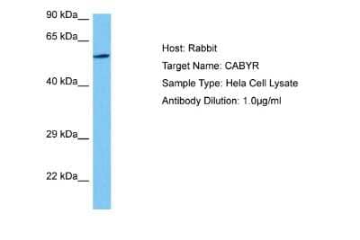 Western Blot: CABYR Antibody [NBP2-87109] - Host: Rabbit. Target Name: CABYR. Sample Tissue: Human Hela Whole Cell lysates. Antibody Dilution: 1ug/ml