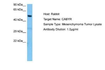 Western Blot: CABYR Antibody [NBP2-87110] - Host: Rabbit. Target Name: CABYR. Sample Tissue: Human Mesenchymoma Tumor lysates. Antibody Dilution: 1ug/ml