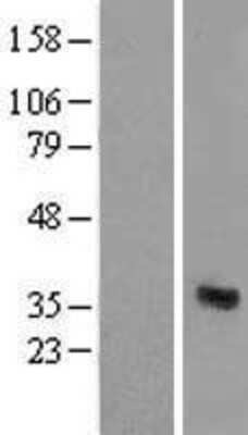 Western Blot: CABYR Overexpression Lysate (Adult Normal) [NBL1-08626] Left-Empty vector transfected control cell lysate (HEK293 cell lysate); Right -Over-expression Lysate for CABYR.