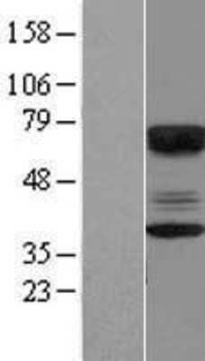 Western Blot: CABYR Overexpression Lysate (Adult Normal) [NBP2-07476] Left-Empty vector transfected control cell lysate (HEK293 cell lysate); Right -Over-expression Lysate for CABYR.