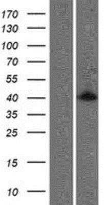 Western Blot CAC1 Overexpression Lysate