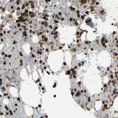 Immunohistochemistry-Paraffin: CACHD1 Antibody [NBP1-82902] - Staining of human bone marrow shows strong cytoplasmic positivity in subsets of bone marrow poietic cells.