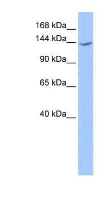 Western Blot: CACHD1 Antibody [NBP1-59989] - Human Brain lysate, concentration 0.2-1 ug/ml.
