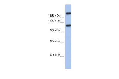 Western Blot: CACNA1I Antibody [NBP2-88775] - WB Suggested Anti-CACNA1I Antibody Titration: 0.2-1 ug/ml. ELISA Titer: 1:62500. Positive Control: Human Small Intestine