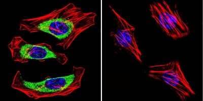 Immunocytochemistry/Immunofluorescence: CACNA2D1 Antibody (20A) [NB120-2864] - Cells were grown on chamber slides and fixed with formaldehyde prior to staining. Cells were probed without (control) or with a Dihydropyridine Receptor alpha-2 monoclonal antibody at a dilution of 1:100 overnight at 4 C, washed with PBS and incubated with a DyLight-488 conjugated secondary antibody and nuclei with DAPI (blue) is shown.