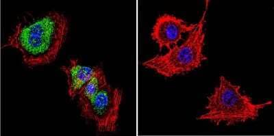 Immunocytochemistry/Immunofluorescence: CACNA2D1 Antibody (20A) [NB120-2864] - Cells were grown on chamber slides and fixed with formaldehyde prior to staining. Cells were probed without (control) or with a Dihydropyridine Receptor alpha-2 monoclonal antibody at a dilution of 1:20 overnight at 4 C, washed with PBS and incubated with a DyLight-488 conjugated secondary antibody and nuclei with DAPI (blue) is shown.