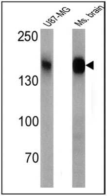 Western Blot: CACNA2D1 Antibody (20A) [NB120-2864] - Analysis of 25 ug of U87-MG (lane 1) and mouse brain (lane 2) cell lysates.