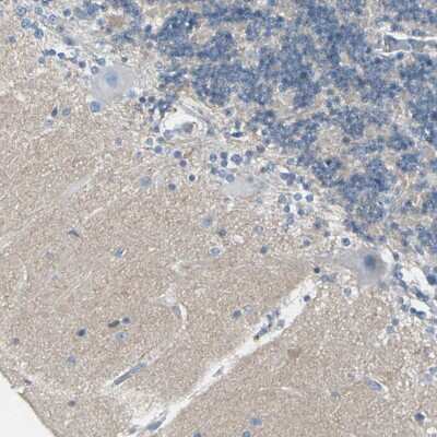 Immunohistochemistry-Paraffin: CACNA2D1 Antibody [NBP1-86682] - Staining of human cerebellum shows moderate positivity.