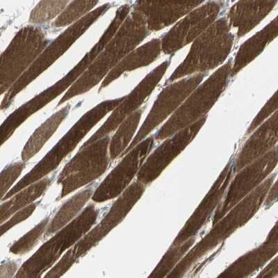 Immunohistochemistry-Paraffin: CACNA2D1 Antibody [NBP1-86682] - Staining of human skeletal muscle shows strong cytoplasmic positivity in myocytes.