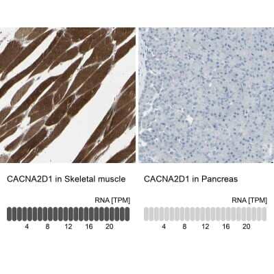 Immunohistochemistry-Paraffin CACNA2D1 Antibody - BSA Free