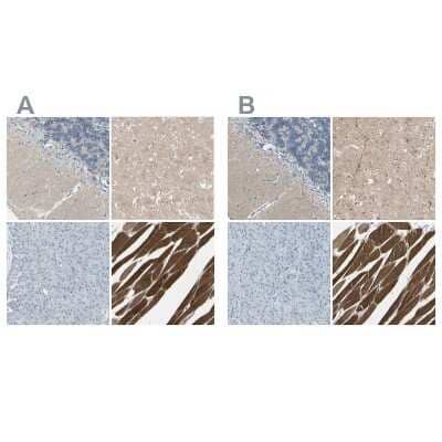 <b>Independent Antibodies Validation and Orthogonal Strategies Validation.</b>Immunohistochemistry-Paraffin: CACNA2D1 Antibody [NBP1-86682] - Staining of human cerebellum, cerebral cortex, pancreas and skeletal muscle using Anti-CACNA2D1 antibody NBP1-86682 (A) shows similar protein distribution across tissues to independent antibody NBP1-86683 (B).