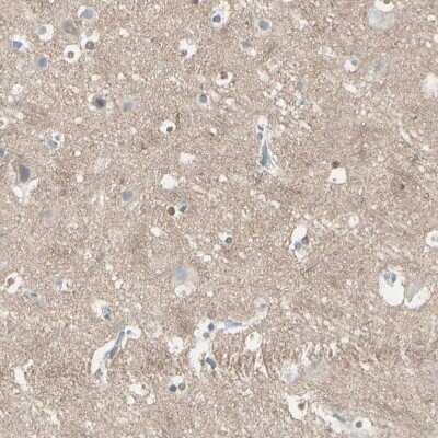 Immunohistochemistry-Paraffin: CACNA2D1 Antibody [NBP1-86682] - Staining of human cerebral cortex shows weak positivity in neuropil.