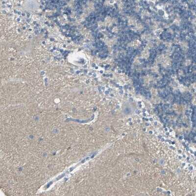 Immunohistochemistry-Paraffin: CACNA2D1 Antibody [NBP1-86683] - Staining of human cerebellum shows weak positivity in neuropil.