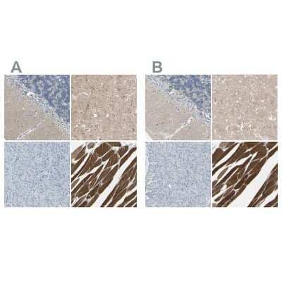 <b>Independent Antibodies Validation and Orthogonal Strategies Validation.</b>Immunohistochemistry-Paraffin: CACNA2D1 Antibody [NBP1-86683] - Staining of human cerebellum, cerebral cortex, pancreas and skeletal muscle using Anti-CACNA2D1 antibody NBP1-86683 (A) shows similar protein distribution across tissues to independent antibody NBP1-86682 (B).