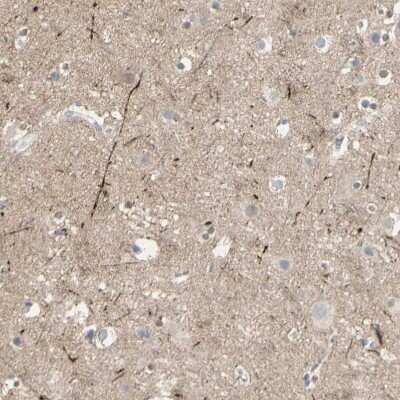 Immunohistochemistry-Paraffin: CACNA2D1 Antibody [NBP1-86683] - Staining of human cerebral cortex shows moderate positivity in neuropil.