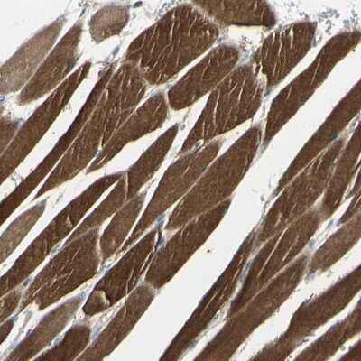 Immunohistochemistry-Paraffin: CACNA2D1 Antibody [NBP1-86683] - Staining of human skeletal muscle shows strong cytoplasmic positivity in myocytes.