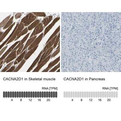 Immunohistochemistry-Paraffin CACNA2D1 Antibody - BSA Free