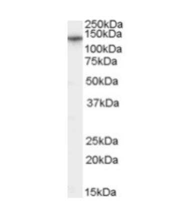 Western Blot: CACNA2D1 Antibody [NB100-60951] - Staining of Human Brain (Cerebellum) lysate (35ug protein in RIPA buffer). Primary incubation was 1 hour. Detected by chemiluminescence.