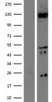 Western Blot: CACNA2D1 Overexpression Lysate (Adult Normal) [NBP2-08998] Left-Empty vector transfected control cell lysate (HEK293 cell lysate); Right -Over-expression Lysate for CACNA2D1.