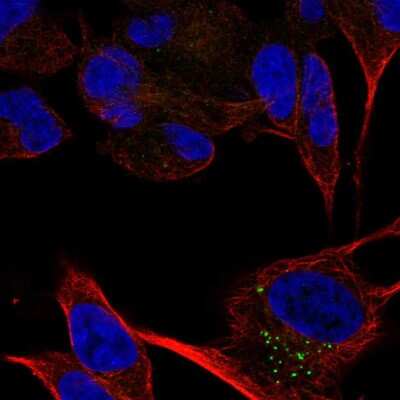 Immunocytochemistry/Immunofluorescence: CACNA2D2 Antibody [NBP2-57784] - Staining of human cell line SH-SY5Y shows localization to vesicles. Antibody staining is shown in green.