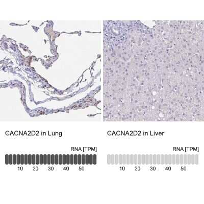 Immunohistochemistry-Paraffin CACNA2D2 Antibody