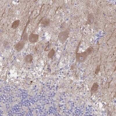 Immunohistochemistry-Paraffin CACNA2D2 Antibody