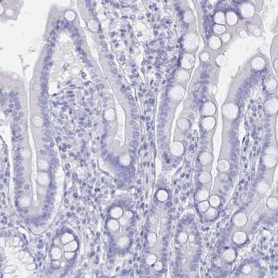 Immunohistochemistry-Paraffin CACNA2D2 Antibody