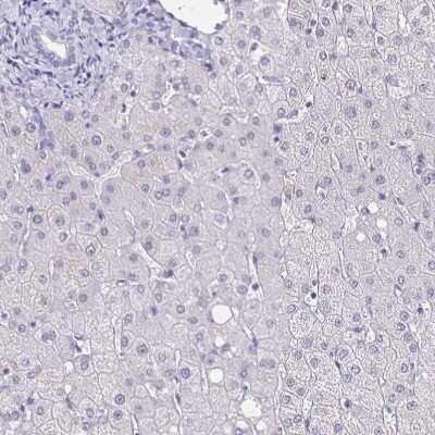 <b>Orthogonal Strategies Validation. </b>Immunohistochemistry-Paraffin: CACNA2D2 Antibody [NBP1-81501] - Staining of human liver shows no cytoplasmic positivity in hepatocytes as expected.