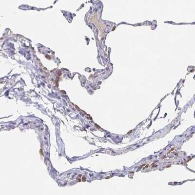 Immunohistochemistry-Paraffin: CACNA2D2 Antibody [NBP1-81501] - Staining of human lung shows moderate cytoplasmic positivity in pneumocytes.