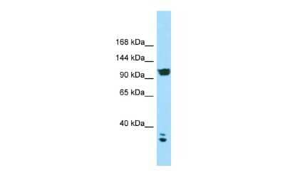 Western Blot: CACNA2D2 Antibody [NBP3-10676] - Western blot analysis of CACNA2D2 in HCT15 Whole Cell as a positive control. Antibody dilution at 1.0 ug/ml