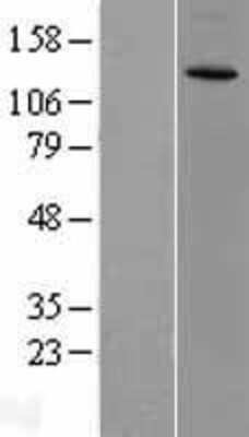 Western Blot: CACNA2D3 Overexpression Lysate (Adult Normal) [NBL1-08627] Left-Empty vector transfected control cell lysate (HEK293 cell lysate); Right -Over-expression Lysate for CACNA2D3.