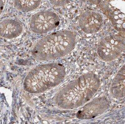 Immunohistochemistry-Paraffin CACNA2D4 Antibody