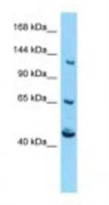 Western Blot: CACNA2D4 Antibody [NBP1-98469] - Mouse Pancreas Lysate 1.0ug/ml, Gel Concentration: 6-18%