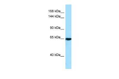 Western Blot: CACNA2D4 Antibody [NBP2-87111] - Host: Rabbit. Target Name: CACNA2D4. Sample Type: A549 Whole Cell lysates. Antibody Dilution: 1.0ug/ml