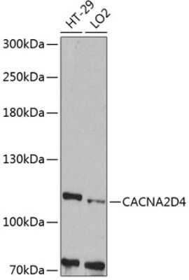 Western Blot: CACNA2D4 Antibody [NBP2-92067] - Analysis of extracts of various cell lines, using CACNA2D4 at 1:1000 dilution.Secondary antibody: HRP Goat Anti-Rabbit IgG (H+L) at 1:10000 dilution.Lysates/proteins: 25ug per lane.Blocking buffer: 3% nonfat dry milk in TBST.Detection: ECL Basic Kit .Exposure time: 90s.