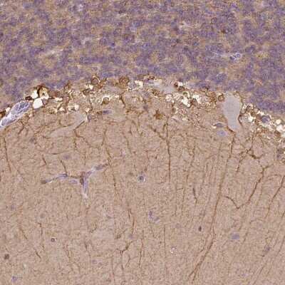 Immunohistochemistry-Paraffin: CACNB1 Antibody [NBP1-86681] - Staining of human cerebellum shows strong positivity in neuronal cells and projections in molecular layer.