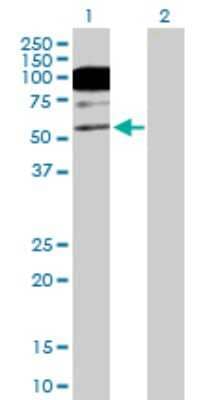 Western Blot: CACNB1 Antibody [H00000782-B01P] - Analysis of CACNB1 expression in transfected 293T cell line by CACNB1 polyclonal antibody.  Lane1:CACNB1 transfected lysate(65.78 KDa). Lane2:Non-transfected lysate.