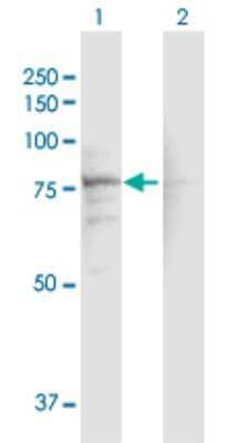 Western Blot: CACNB1 Antibody [H00000782-D01P] - Analysis of CACNB1 expression in transfected 293T cell line by CACNB1 polyclonal antibody.Lane 1: CACNB1 transfected lysate(65.70 KDa).Lane 2: Non-transfected lysate.