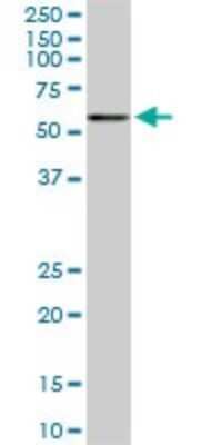 Western Blot: CACNB2 Antibody (6C1) [H00000783-M01] - CACNB2 monoclonal antibody (M01), clone 6C1. Analysis of CACNB2 expression in NIH/3T3.