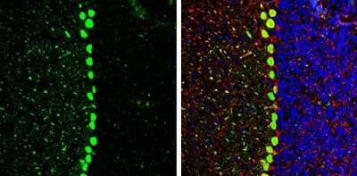 Immunohistochemistry-Frozen: CACNB2 Antibody [NBP3-13049] - CACNB2 antibody detects CACNB2 protein by immunohistochemical analysis. Sample: Frozen-sectioned mouse mouse cerebellum. Green: CACNB2 stained by CACNB2 antibody (NBP3-13049) diluted at 1:250. Red: NF-H, stained by NF-H antibody [GT114] diluted at 1:500. Blue: Fluoroshield with DAPI. Antigen Retrieval: Citrate buffer, pH 6.0, 10 min