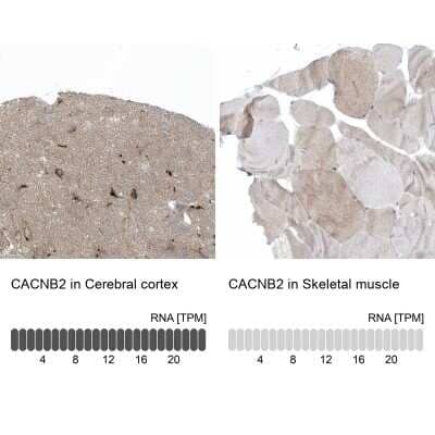 Immunohistochemistry-Paraffin CACNB2 Antibody