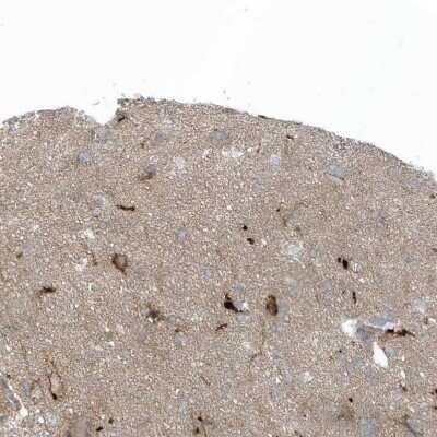 Immunohistochemistry-Paraffin CACNB2 Antibody