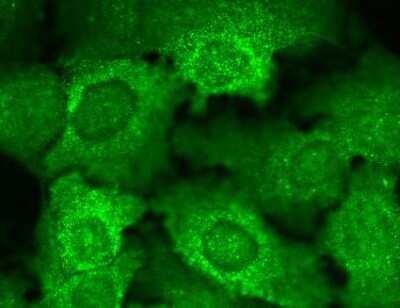 Immunocytochemistry/Immunofluorescence: CACNB2 Antibody (N8b/1) [NBP1-47607] - Tissue: HaCaT cells. Species: Human. Fixation: Cold 100% methanol at -20C for 10 minutes. Primary Antibody at 1:100 for 1 hour at RT. Secondary Antibody: FITC Goat Anti-Mouse (green) at 1:50 for 1 hour at RT. Localization: All cells positive. Bright dottiness located throughout cytoplasm and in nuclei.. Image courtesy of Dr. Turksen, Ottawa Hospital Research Institute, Canada.