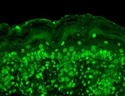 Immunohistochemistry: CACNB2 Antibody (N8b/1) [NBP1-47607] - Immunohistochemistry analysis using Mouse Anti-Cav Beta2 Calcium Channel Monoclonal Antibody, Clone S8b-1 (NBP1-47607). Tissue: backskin. Species: Mouse. Fixation: Bouin's Fixative and paraffin-embedded. Primary Antibody: Mouse Anti-Cav Beta2 Calcium Channel Monoclonal Antibody (NBP1-47607) at 1:100 for 1 hour at RT. Secondary Antibody: FITC Goat Anti-Mouse (green) at 1:50 for 1 hour at RT. Localization: All nuclei. Some nuclei also staining higher up in epidermis.