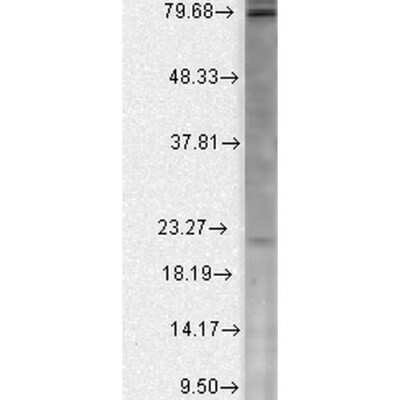 Western Blot CACNB2 Antibody (N8b/1)